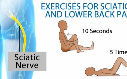 Exercises for Sciatica and