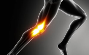 Knee pain after workout